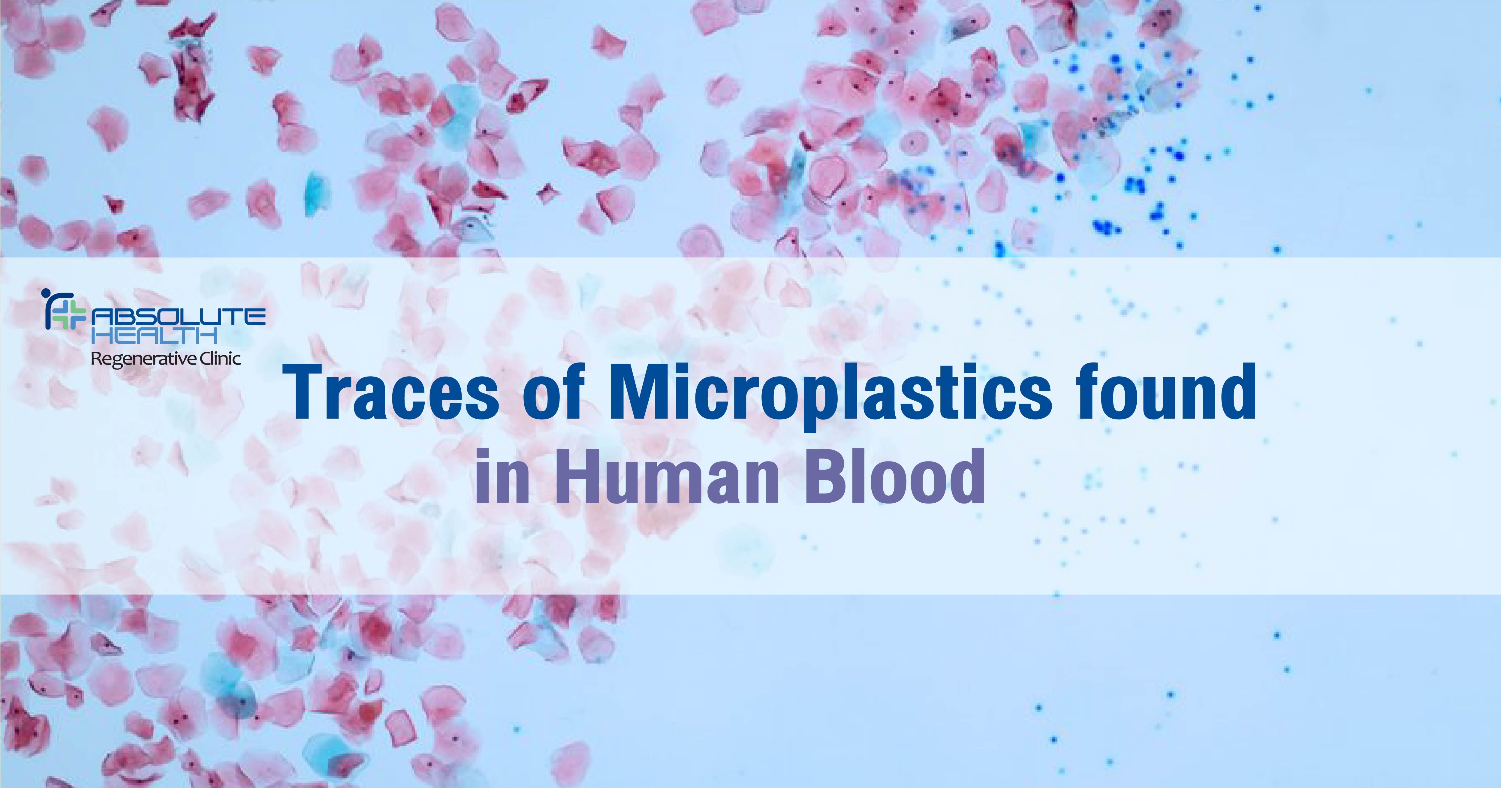 Traces of Microplastics found in Human Blood 