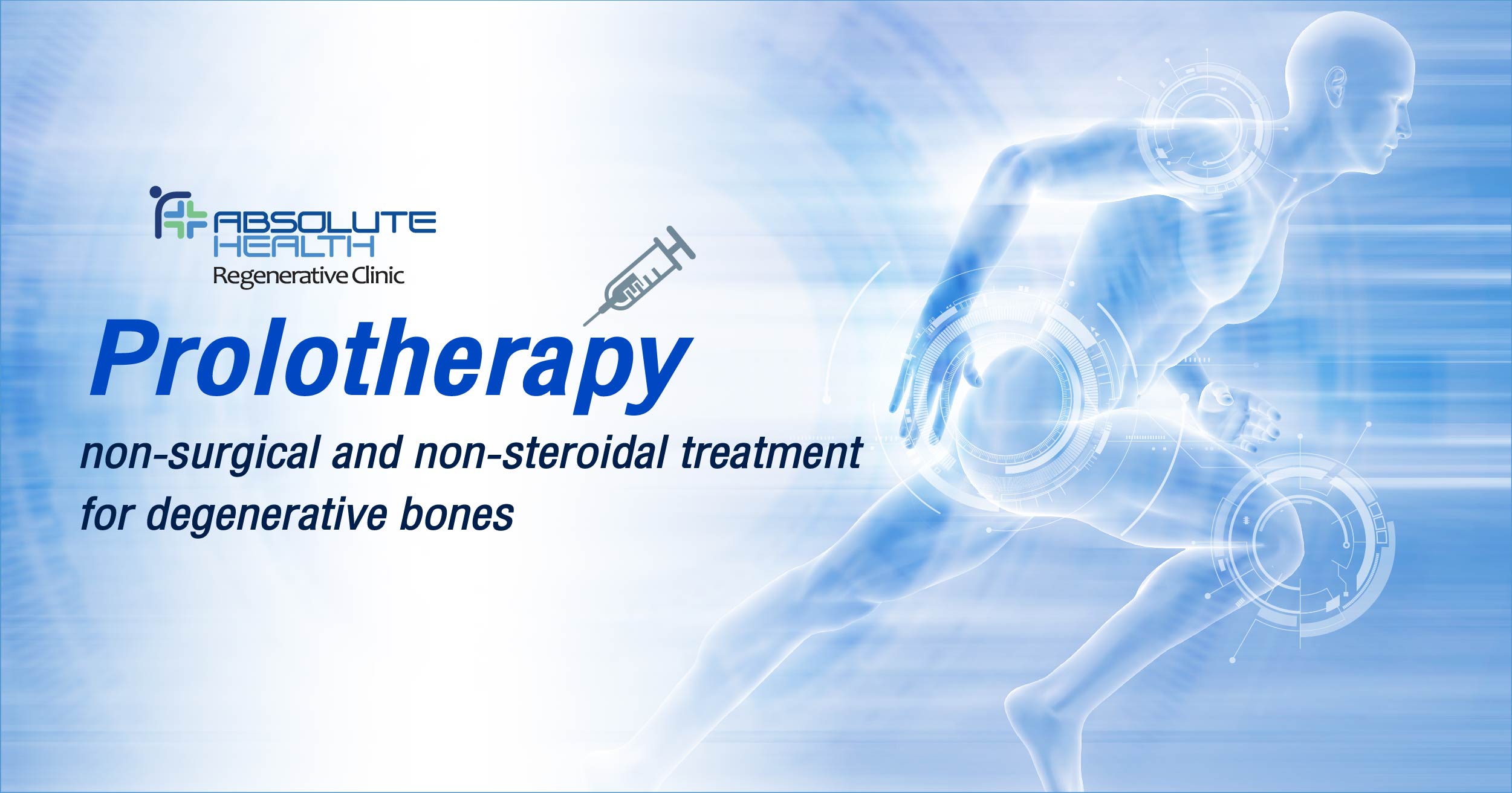 Prolotherapy
