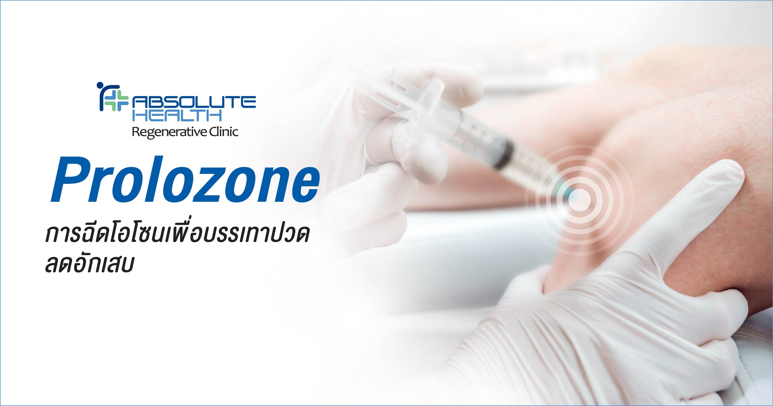 Prolozone การฉีดโอโซนเพื่อบรรเทาปวด ลดอักเสบ