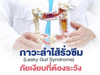 “ภาวะลำไส้รั่วซึม” (Leaky Gut Syndrome) ภัยเงียบที่ต้องระวัง